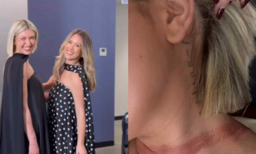 O influenceriță a fost „aproape decapitată” după ce eșarfa de mătase i s-a prins în mașină/ Foto: Captură video Instagram