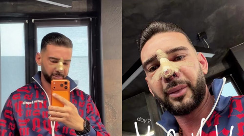 Dorian Popa, pe masa de operație timp de 6 ore și jumătate/ Foto: Captură video Instagram