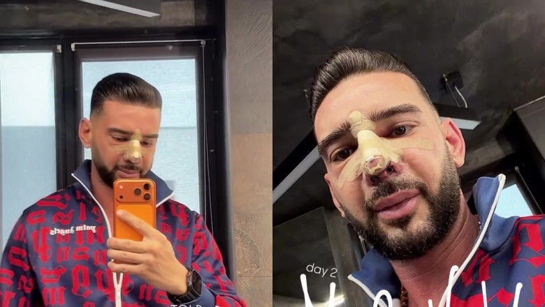 Dorian Popa, pe masa de operație timp de 6 ore și jumătate/ Foto: Captură video Instagram