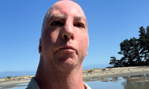 Influencer with 'Birdman syndome' who beat the odds reveals doctors said he 'wouldn't live past 24 hours'