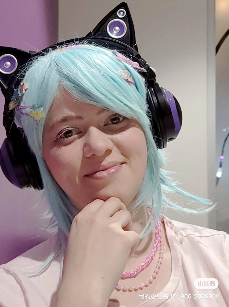 ‘Doctors said it was just allergies – but my bulging eyes turned out to be a rare disease that left me hospitalised almost 50 times’