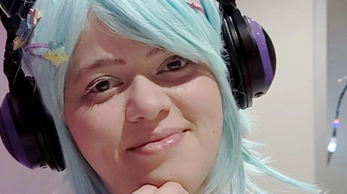 ‘Doctors said it was just allergies – but my bulging eyes turned out to be a rare disease that left me hospitalised almost 50 times’