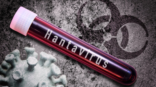 Hantavirus