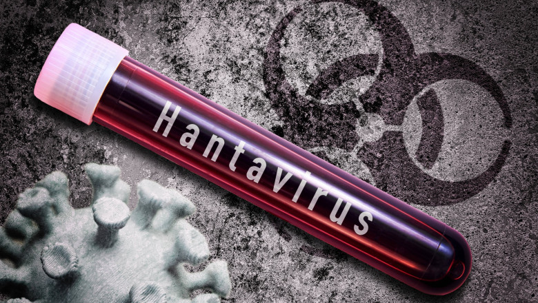 Hantavirus