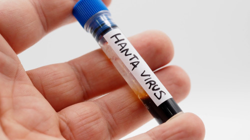 Hantavirus/ Profimedia