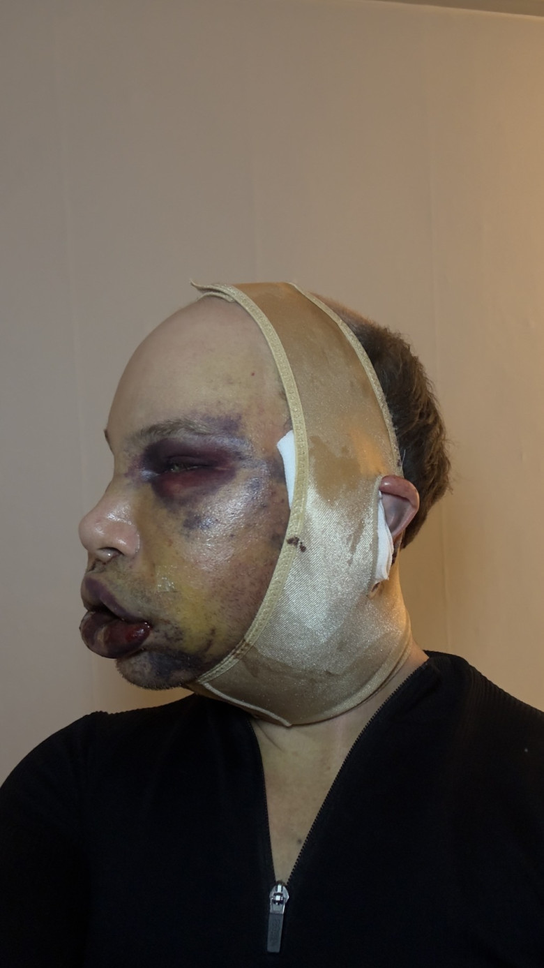 Joni Hesselgren/ Profimedia