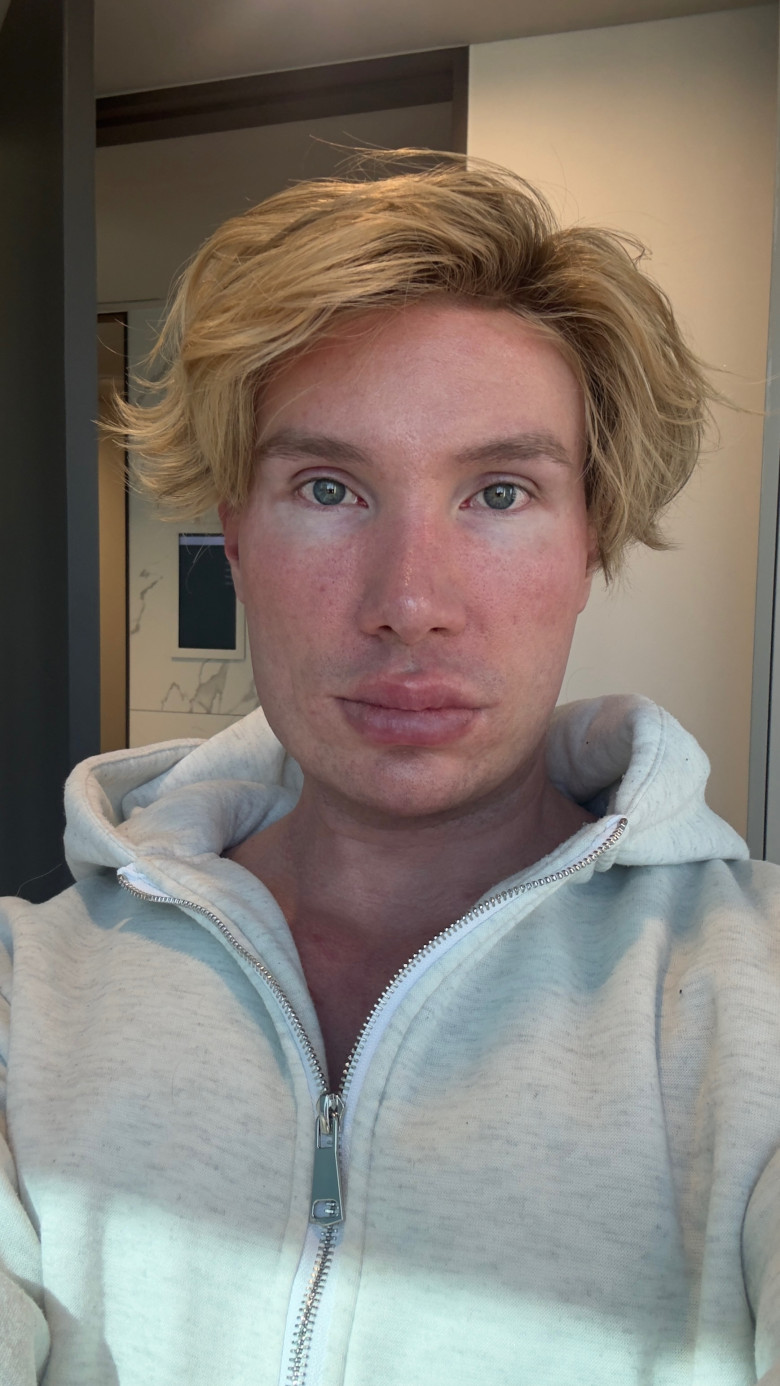 Joni Hesselgren/ Profimedia