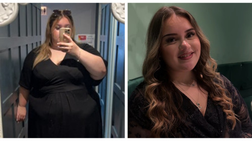O tânără a slăbit 91 de kilograme în doar șapte luni _ Profimedia Images