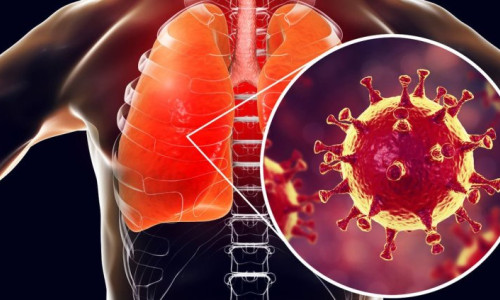 Coronavirus