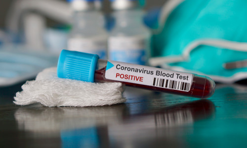 coronavirus 1shutterstock_1622496262