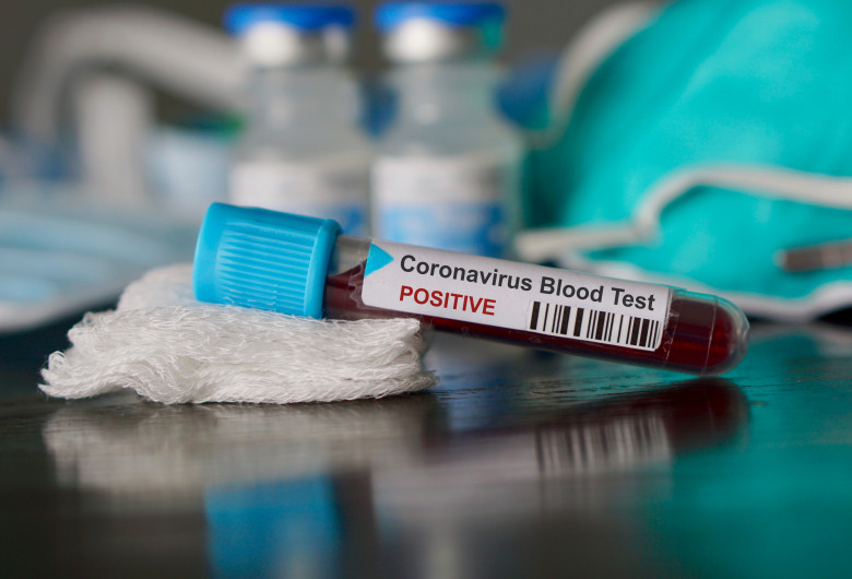coronavirus 1shutterstock_1622496262