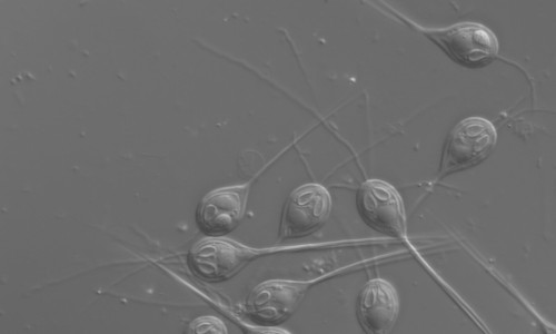 Henneguya salminicola