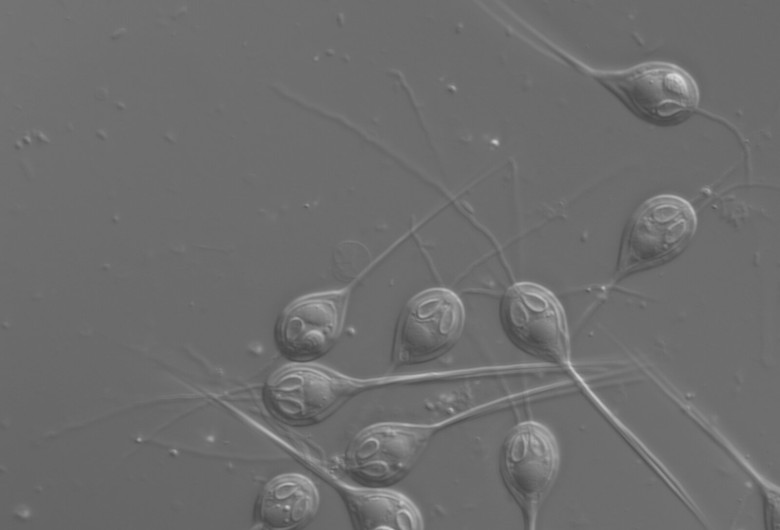 Henneguya salminicola
