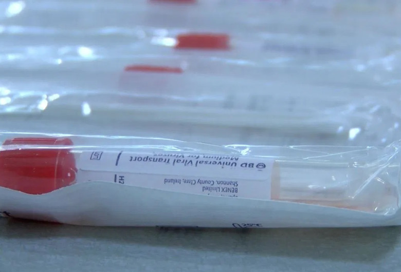 Teste pentru coronavirus, COVID-19