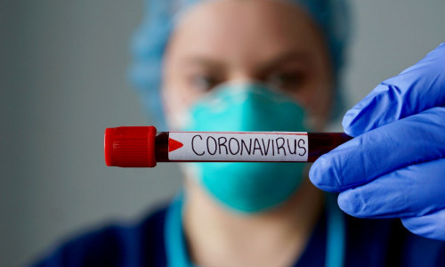 Coronavirus, COVID-19