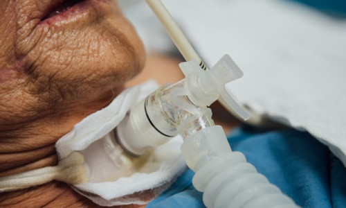 Bătrână cu tub în gât, ventilator de respirație, spital