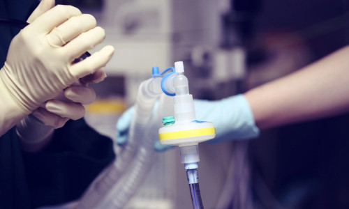 Intubare, probleme respiratorii, ventilat mecanic