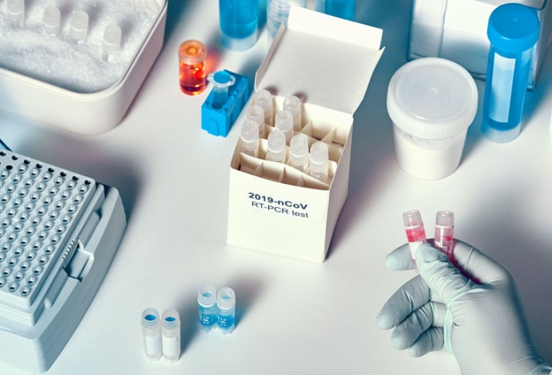 Kit de diagnosticare COVID-19, Real Time PCR, coronavirus