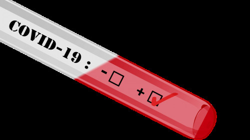 Test coronavirus, COVID-19