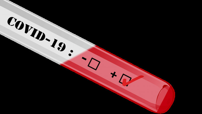 Test coronavirus, COVID-19