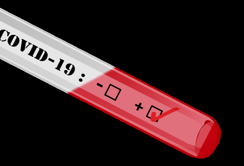 Test coronavirus, COVID-19