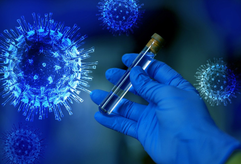 Analiză, test, coronavirus, COVID-19, SARS-CoV-2