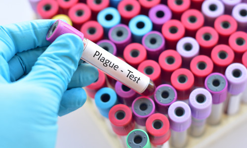 ciuma shutterstock_750197356