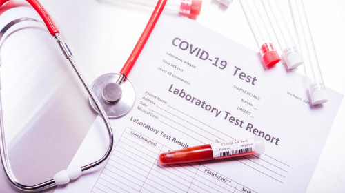 Test de coronavirus, COVID-19