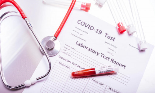 Test de coronavirus, COVID-19