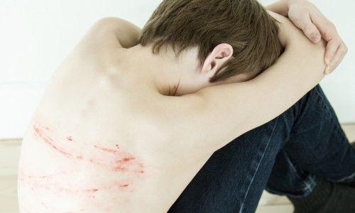 Băiat, copil bătut, agresat, violență domestică, abuzat fizic