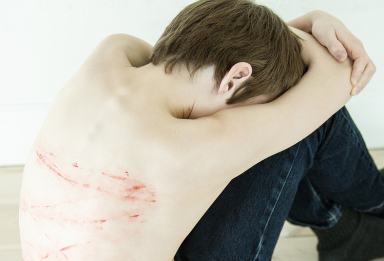 Băiat, copil bătut, agresat, violență domestică, abuzat fizic
