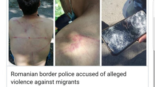 refugiati