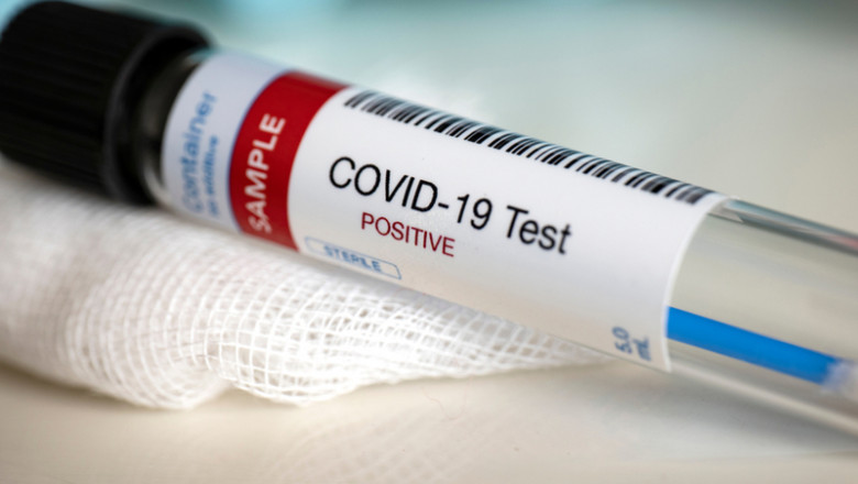 Test pozitiv de coronavirus, COVID-19, SARS-CoV-2