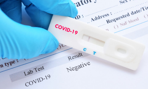 Test negativ de coronavirus, COVID-19, SARS-CoV-2