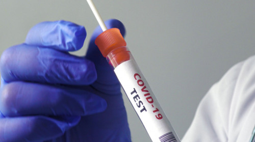 Test de coronavirus, COVID-19, SARS-CoV-2