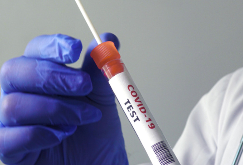 Test de coronavirus, COVID-19, SARS-CoV-2