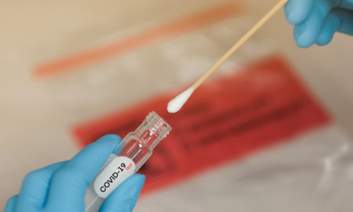 Test de coronavirus, COVID-19, SARS-CoV-2