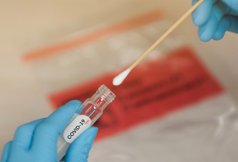 Test de coronavirus, COVID-19, SARS-CoV-2