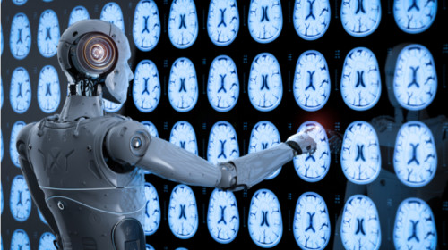 Inteligență artificială, robot în medicină, sanitar, doctor, medic, creier, boli, pacienți, afecțiuni