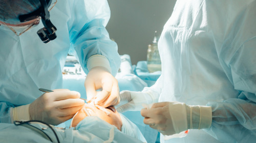 Operație de reconstrucție a feței, nasului, chirurgie estetică, medici, asistente, sanitar, doctori