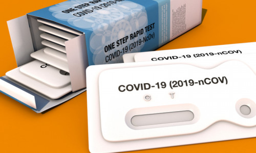 Test rapid antigen pentru coronavirus, COVID-19, SARS-CoV-2