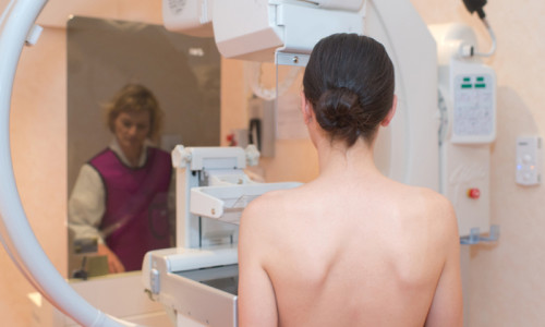 Screening mamar, mamografie, analize de sâni, țâțe