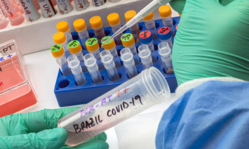 Tulpina braziliană de coronavirus, COVID-19, SARS-CoV-2