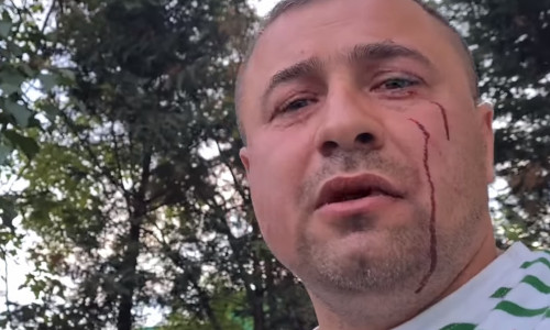 Bătut de agresori de față cu polițiștii