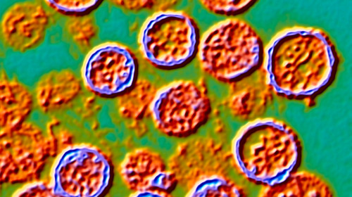 Hantavirus particles, TEM