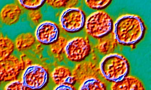 Hantavirus particles, TEM