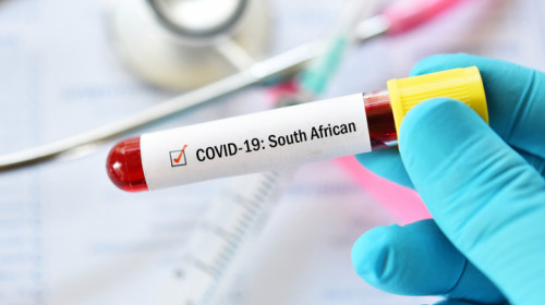 Tulpina africană a coronavirusului SARS-CoV-2 care dă COVID-19