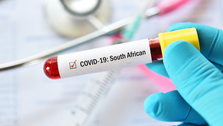 Tulpina africană a coronavirusului SARS-CoV-2 care dă COVID-19