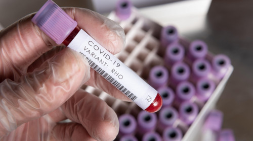 WHO covid-19 SARS variants of concern or interest of coronavirus, blood sample positive result for variant held in latex gloved hand