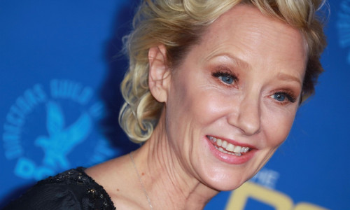 Anne Heche Declared Legally Dead at Age 53*File Photos* **FILE PHOTOS**